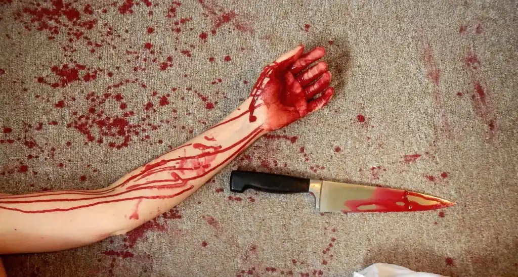 Muslim Man’s Hand Cut Off When Attackers Saw ‘786’ Tattooed on His Arm